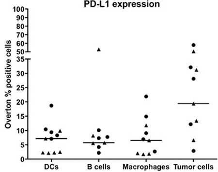 Expression of PD-L1 on immune cells and tumor cells in pleural and ascites fluids of MPM patients.