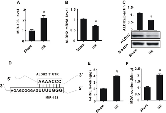 The effect of cerebral ischemia/reperfusion injury on the expression of miR-193, ALDH2, and the accumulation of toxic aldehydes.