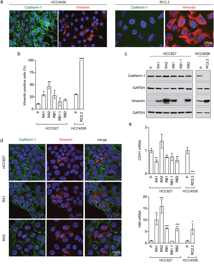 EMT features in erlotinib-resistant NSCLC cell lines.