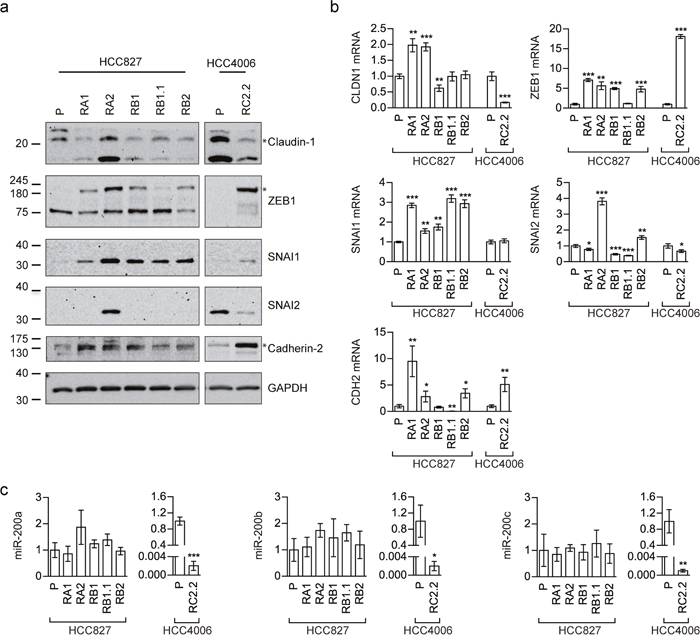 EMT markers expression in erlotinib-sensitive and -resistant cell lines.