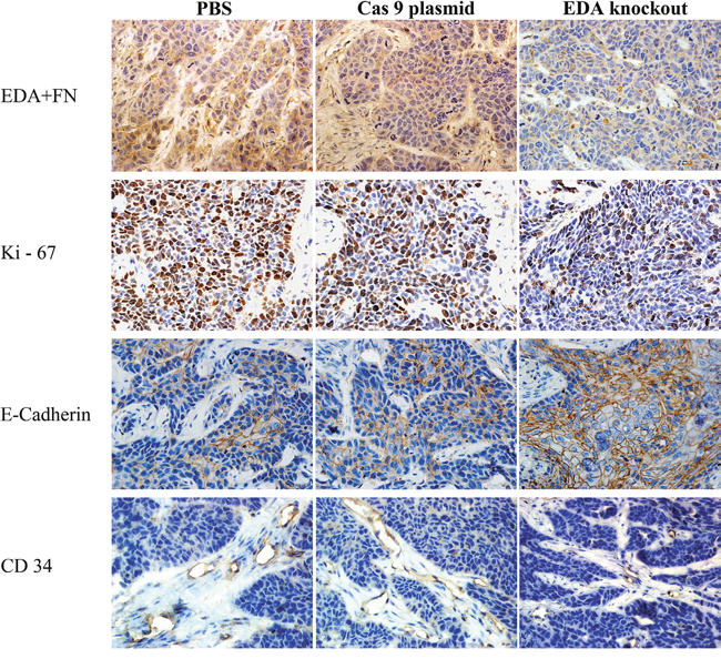 IHC EDA+FN, Ki-67, CD34, and E-cadherin staining of EDA knockout samples of CNE-2Z tumor, as well as the samples of PBS or Cas9 plasmid groups.