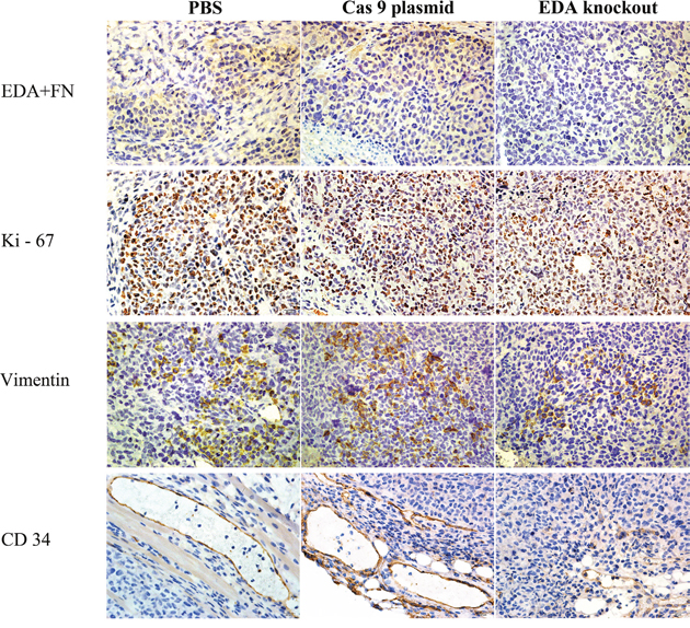 IHC EDA+FN, Ki-67, Vimentin and CD34 staining of EDA knockout sample of SW480 tumor, as well as the samples of PBS or Cas9 plasmid groups.