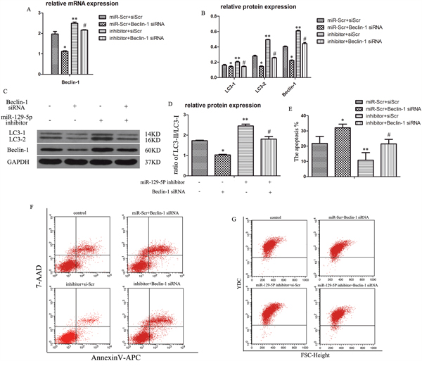 MiR-129-5P regulates degenerative human NP cell autophagy by directly targeting Beclin-1.