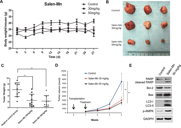 Salen-Mn inhibits the growth of prostate cancer cell xenograft in vivo.