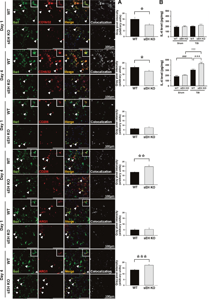 Deletion of sEH reduced proinflammatory microglia/macrophage activation and heightened anti-inflammatory microglia/macrophage response after TBI.