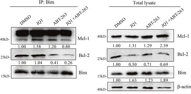 Combination treatment of JQ1 and ABT-263 strongly disrupts the interaction of Bim with Bcl-2 and Mcl-1.