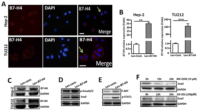 Overexpression of B7-H4 in both Hep-2 and TU212 cells promotes the expression of EMT-associated markers.