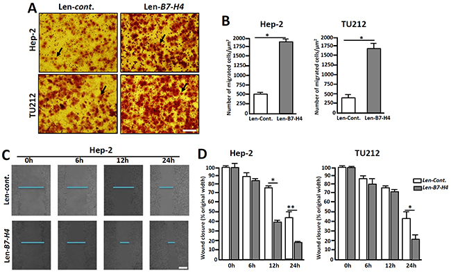 Overexpression of B7-H4 in Hep-2/TU212 cells promotes cell invasion and metastasis.