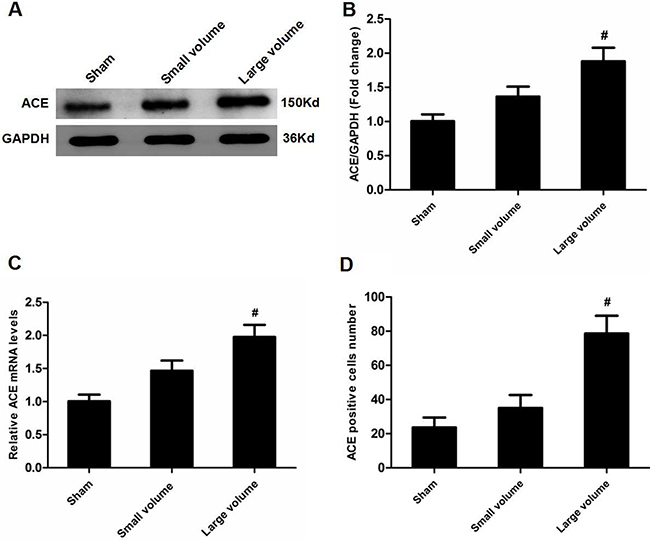 Effect of infarct volume on ACE expression in peri-infarct regions at 24 h after pMCAO.