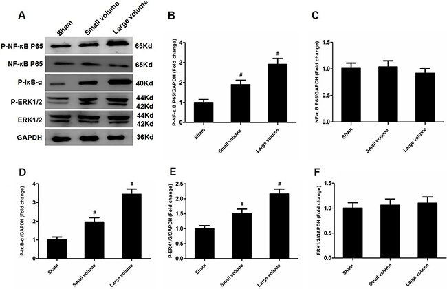 Effect of infarct volume on activation of ERK and NF-&#x03BA;B in peri-infarct regions at 24 h after pMCAO.