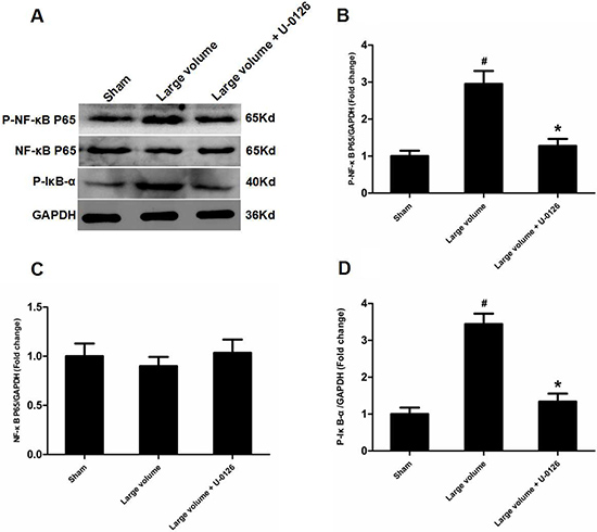 Inhibition of ERK is involved in deactivation of NF-&#x03BA;B in peri-infarct regions induced by pMCAO.