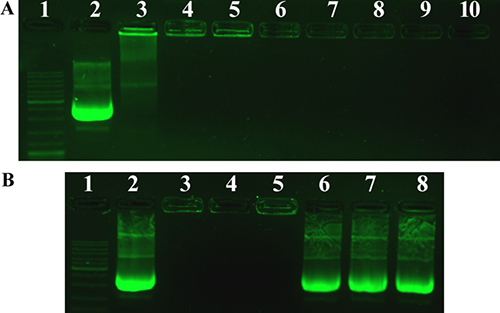 Agarose gel electrophoresis of PF33/pDNA complexes, HAC/pDNA complexes and RRPHC/pDNA nanoparticles.