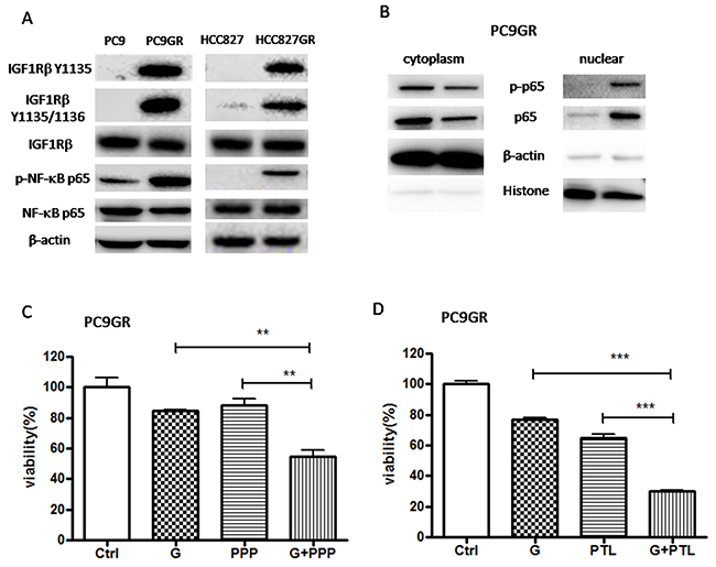 IGF1R/NF-&#x03BA;B p65 signaling was activated in GR cells and inhibition of IGF1R/NF-&#x03BA;B p65 increased the sensitivity of GR cells to gefitinib.