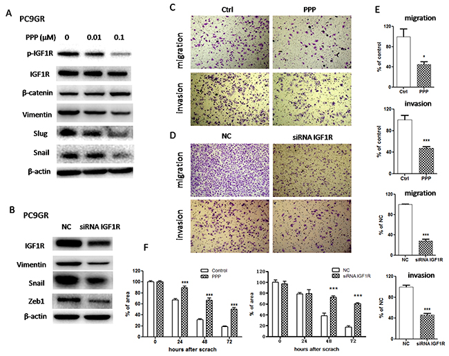 Inhibition of IGF1R reversed EMT and suppressed migration and invasion in PC9GR cells.