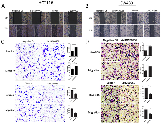 LINC00959 effects on colon cancer cell invasion and migration.