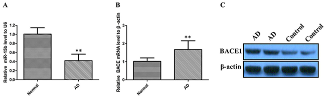 The relative expression of miR-15b and BACE1 were determined by qRT-PCR and western blot in AD patients.