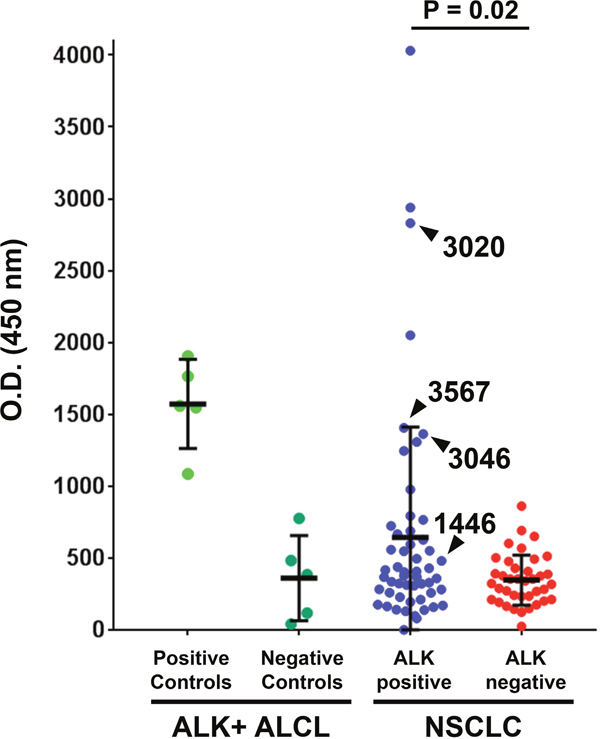 A subset of ALK-positive non-small cell lung cancer (NSCLC) patients have high serum ALK autoantibodies.