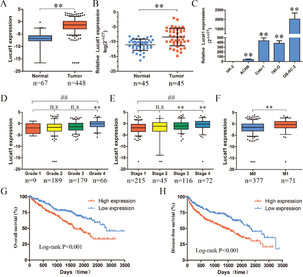 Expression of Lucat1 in ccRCC cell lines, tissues and its clinical parameters.