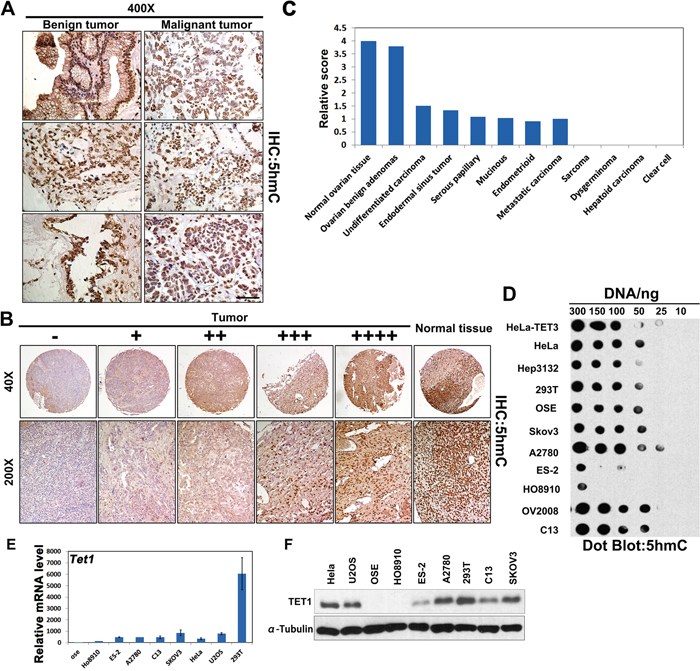 5hmC production in human ovarian cancer samples and cells.