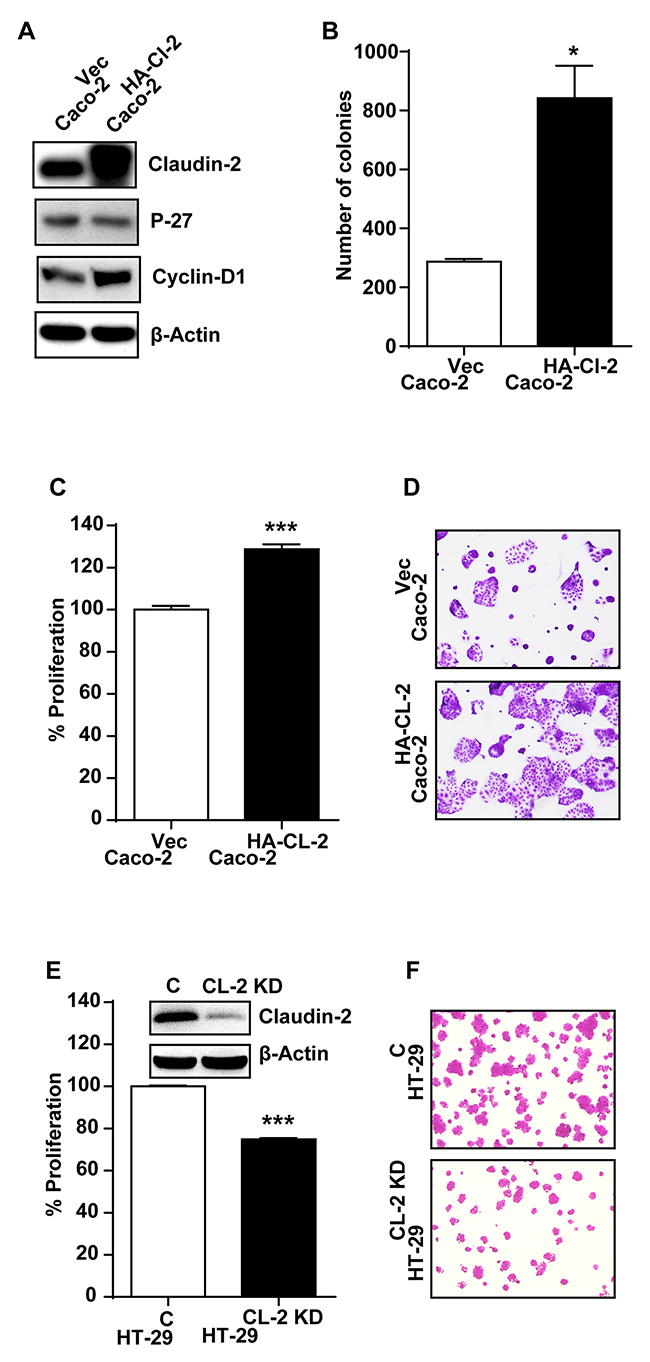 Genetic modulation of claudin-2 expression modulates differentiation program and growth properties in colon cancer cell.