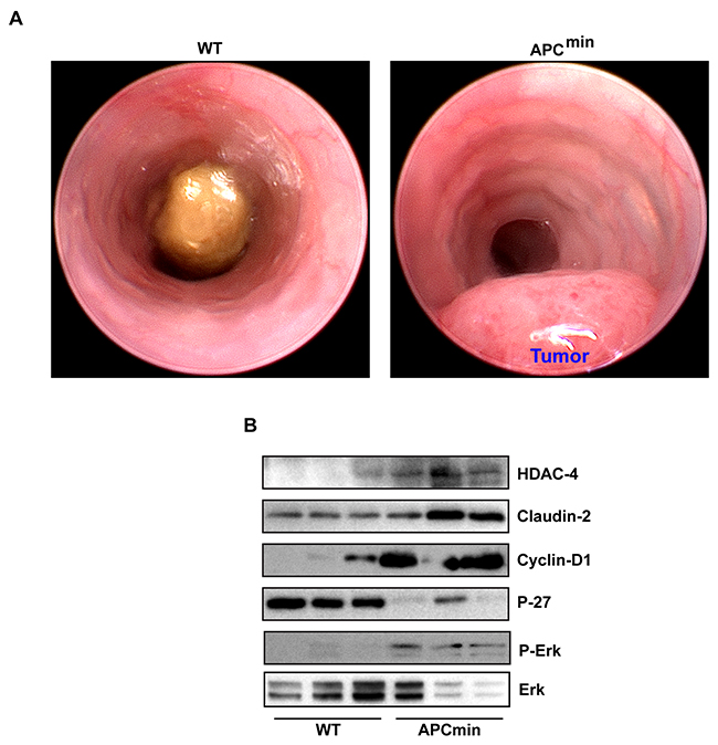 HDAC4/ERK1/2/Claudin-2 axis is highly upregulated in colon cancer.