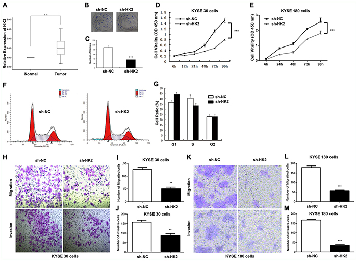 HK2 promoted cell proliferation, invasion and migration in ESCC Cells.