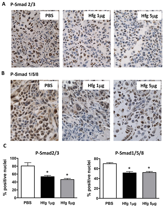 Halofuginone reduces TGF-&#x03B2; and BMP signaling in vivo.
