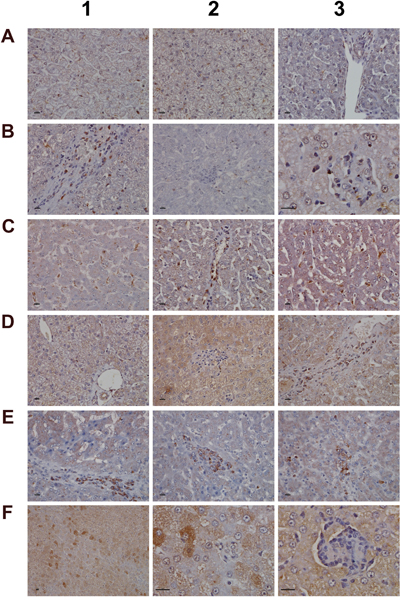 Immunohistochemistry staining of CD205 and CD74 in liver sections of control and diclofenac treated animals after daily dosing for 28 days.
