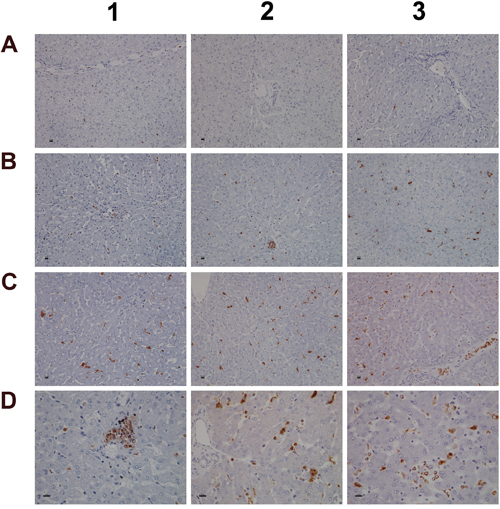 Immunohistochemistry staining of myeloperoxidase in liver sections of control and diclofenac treated animals after daily dosing for 28 days.