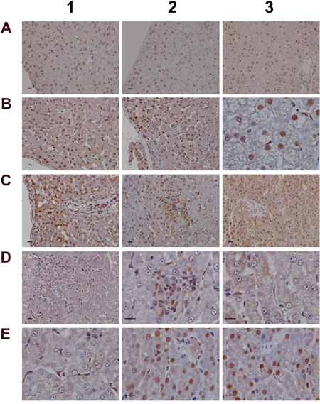 Immunohistochemistry staining of the Kr&uuml;ppel-like factor 6 in liver sections of control and diclofenac treated animals after daily dosing for 28 days.