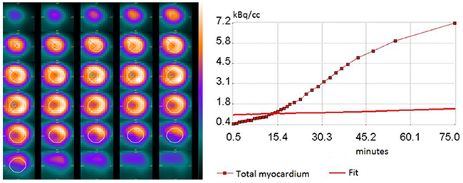 Representative of myocardial time-activity curve together with the 18 F-FDG kinetics fitted model curve (right), and its transverse PET images in fasting mice after intraperitoneal injection of 18 F-FDG (left).