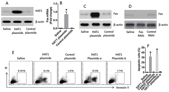 Restoration of HAT1 induces LCCs apoptosis.