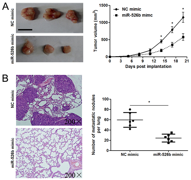 miR-526b restoration restrains tumor growth and lung metastasis of HCC in mice.