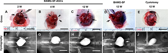 ASCs-seeded BAMG-SF promoted morphological restoration of bladder defect.
