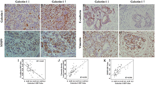 Correlation between Galectin-1 expression and the expression of EMT markers and MMP9.