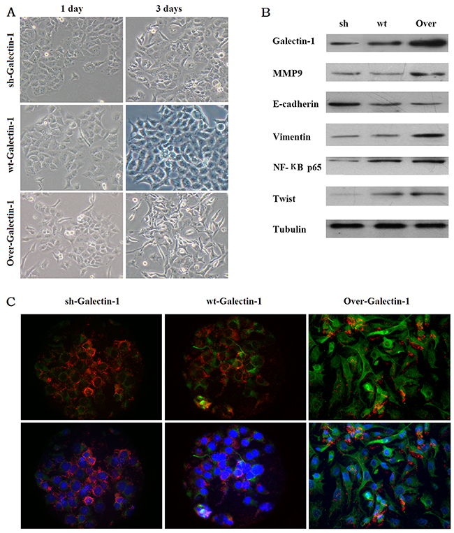 Effect of PSCs derived Galectin-1 expression on PANC-1 phenotype and expression changes.