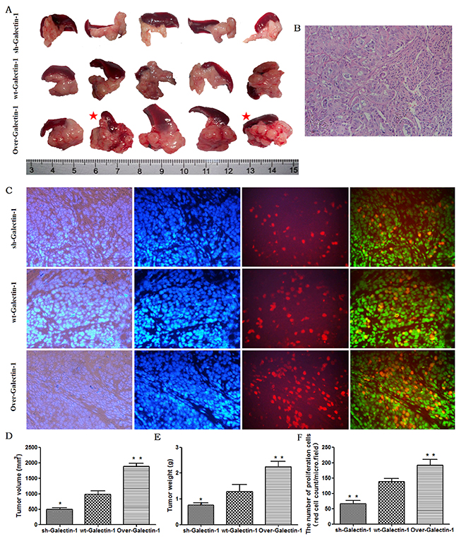 Effect of PSC-derived Galectin-1 on in vivo orthotopic xenograft establishment and growth.