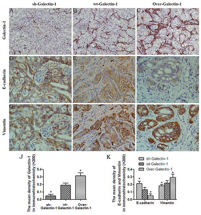 Effect of PSC-derived Galectin-1 on EMT of cancer cells in vivo.