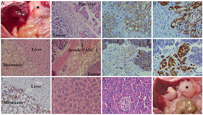 Characteristics of orthotopic tumors in mice with or without liver metastasis.