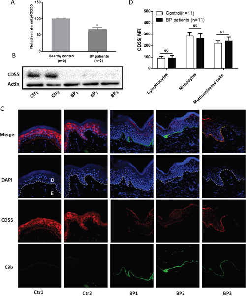 CD55 downregulation in the lesional skin of patients with bullous pemphigoid.