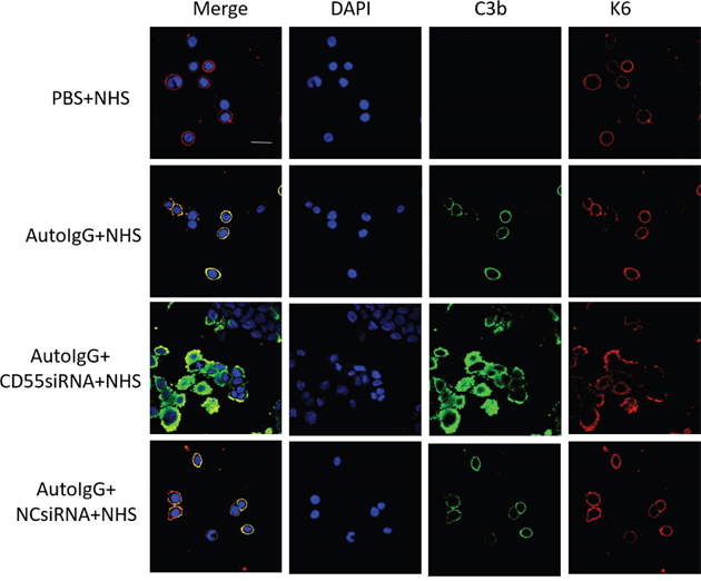 CD55 depletion enhances auto-IgG-mediated C3b deposition in HaCaT cells.