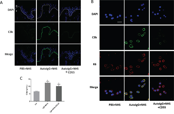 Recombinant CD55 inhibits autoantibody-mediated C3b deposition in bullous pemphigoid pathogenesis.