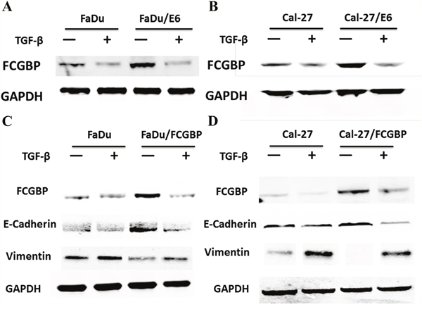 Protein expression level of FcGBP and EMT markers in HNSCC FaDu and Cal-27 cells after HPV E6 and FcGBP overexpression.