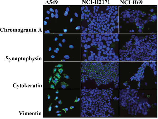 SCLC cells exhibit a characteristic expression of neuroendocrine and differentiation markers.