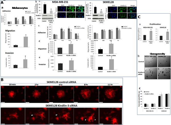 Kindlin-3 silencing enhances malignant properties of tumor cells A.