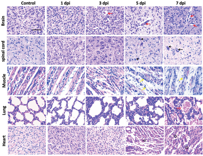Histopathological examinations of tissues in mice after EV71 infection.