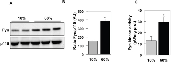 Fyn kinase expression and activity are increased in isolated ATMs and SVF of high fat-fed mice.