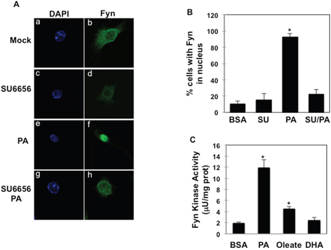 Fyn activity is necessary for palmitate-dependent Fyn nuclear re-localization.