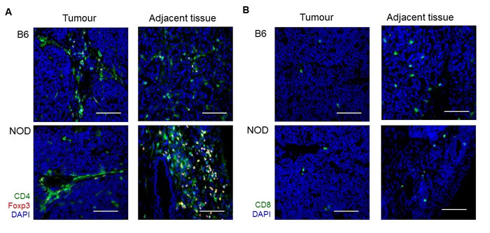 Increased CD4 T cell infiltration adjacent to NOD tumours