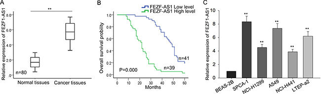 FEZF1-AS1 is upregulated in LAD and is significantly correlated with TNM stage.